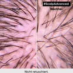 Hydraterende Haarbehandeling|Droog Haar^L’Oréal Professionnel Paris Anti-Discomfort Intense Soother Treatment