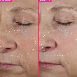 Gezichtstoners^Farmacy Beauty Brighten Up 3% TXA Dark Spot Toner