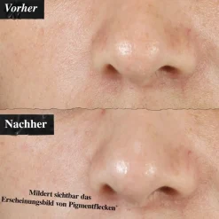 Gezichtsverzorging|Anti-Agingserum^Kiehl's Clearly Corrective Dark Spot Solution