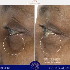 Oogcrème^Augustinus Bader De Oogcrème