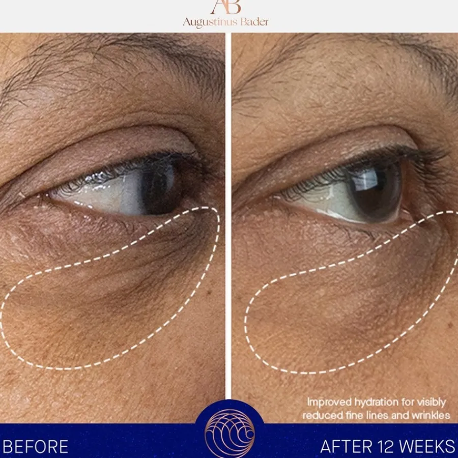 Oogcrème^Augustinus Bader De Oogcrème