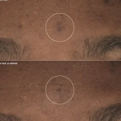 Gezichtscrème^Clinique Even Better Clinical Brightening Moisturizer