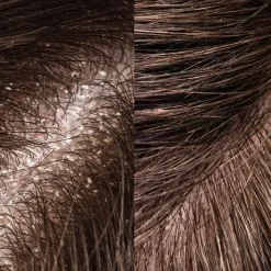 Haarverzorging|Zonnebrand & Verzorging^Rosental Organics Exfoliërende Haarborstel