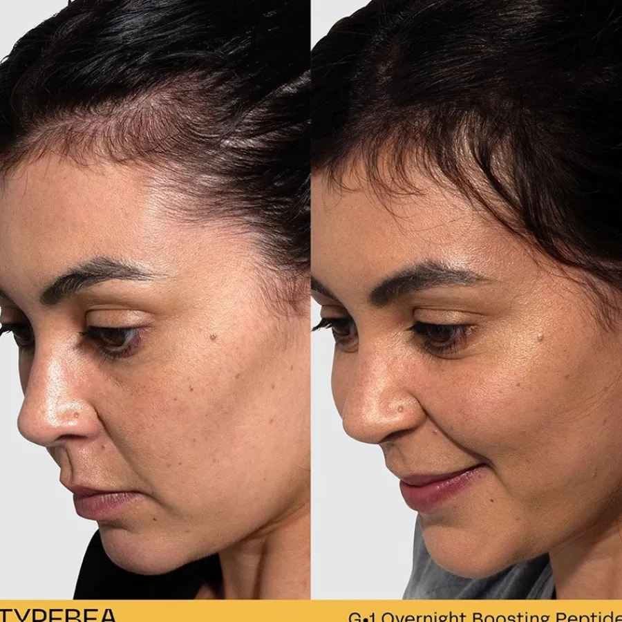 Haarserum^TYPEBEA G1 Overnight Boosting Peptide