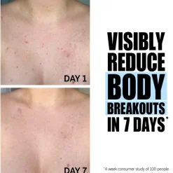 Body Scrub^The INKEY List Glycolic Acid Exfoliating Body Stick