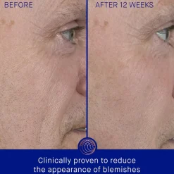 Anti-Agingserum^Augustinus Bader Het serum