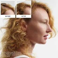 Conditioner Voor Beschadigd Haar^Nioxin Hoofdhuid Therapy Revitaliserende Conditioner, Natuurlijk haar progressieve uitdunning