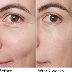 Hyaluronzuurserum^By Terry Hyaluronisch Globaal Serum