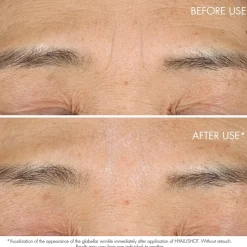 Hydraterend Serum|Anti-Agingserum^DIOR Hyalushot, Rimpel Corrector voor Bestaande & Beginnende Rimpels