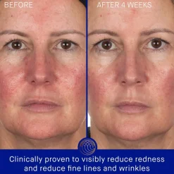 Hydraterende Maskers^Augustinus Bader Hydrogel gezichtsmasker