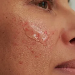 Dado Sens|Gezichtsverzorging^DADO SENS INTENSIEF SERUM, - voor overgevoelige huid & couperose