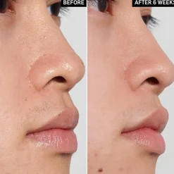 Gezichtspeeling^The INKEY List PHA Toner