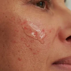 Dado Sens|Gezichtsverzorging^DADO SENS REINIGINGSGEL, - voor overgevoelige huid & couperose