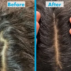 Anti-Roos Crèmespoeling^Umberto Giannini Scalp Reviving Anti-Dandruff Shampoo