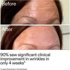 Anti-Agingserum^The INKEY List Starter Retinol Serum