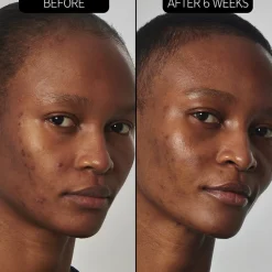 Hyaluronzuurserum^The INKEY List SuperSolutions 20% Niacinamide Serum