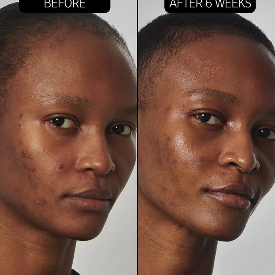 Hyaluronzuurserum^The INKEY List SuperSolutions 20% Niacinamide Serum