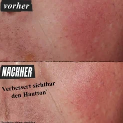 Antirimpelcrème|Gezichtscrème^Kiehl's Ultra Facial Advanced Repair Barrier Cream