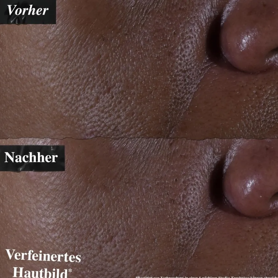 Anti-Agingserum|Antirimpelcrème^Kiehl's Ultra Pure High-Potency Serum 9,8% Glycolic Acid