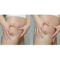 Cellulitis Creme|Hyaluronzuurserum^Foreo Verstevigend lichaamsserum